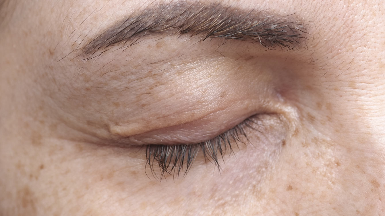Œil fermé aux cils plus longs après cinq mois de RevitaLash Advanced