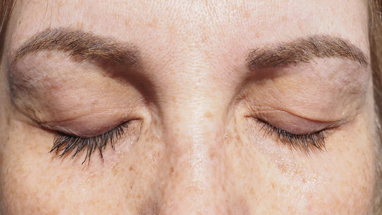 Comparaison entre un œil avec mascara et un œil sans maquillage après cinq mois de RevitaLash